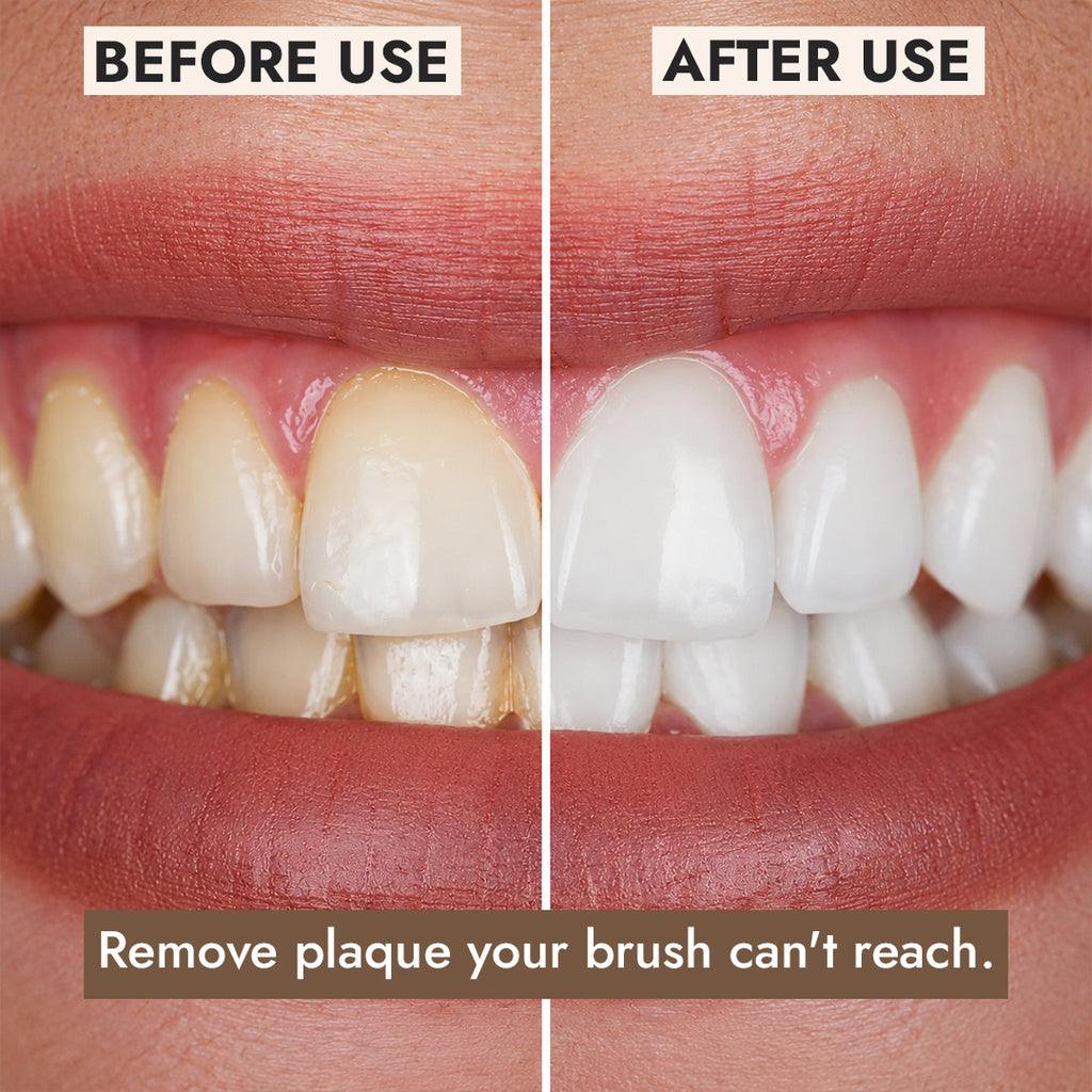 Pro Ultrasonic Plaque Remover